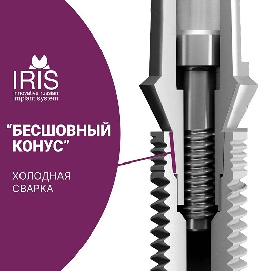 Беззазорное соединение - холодная сварка