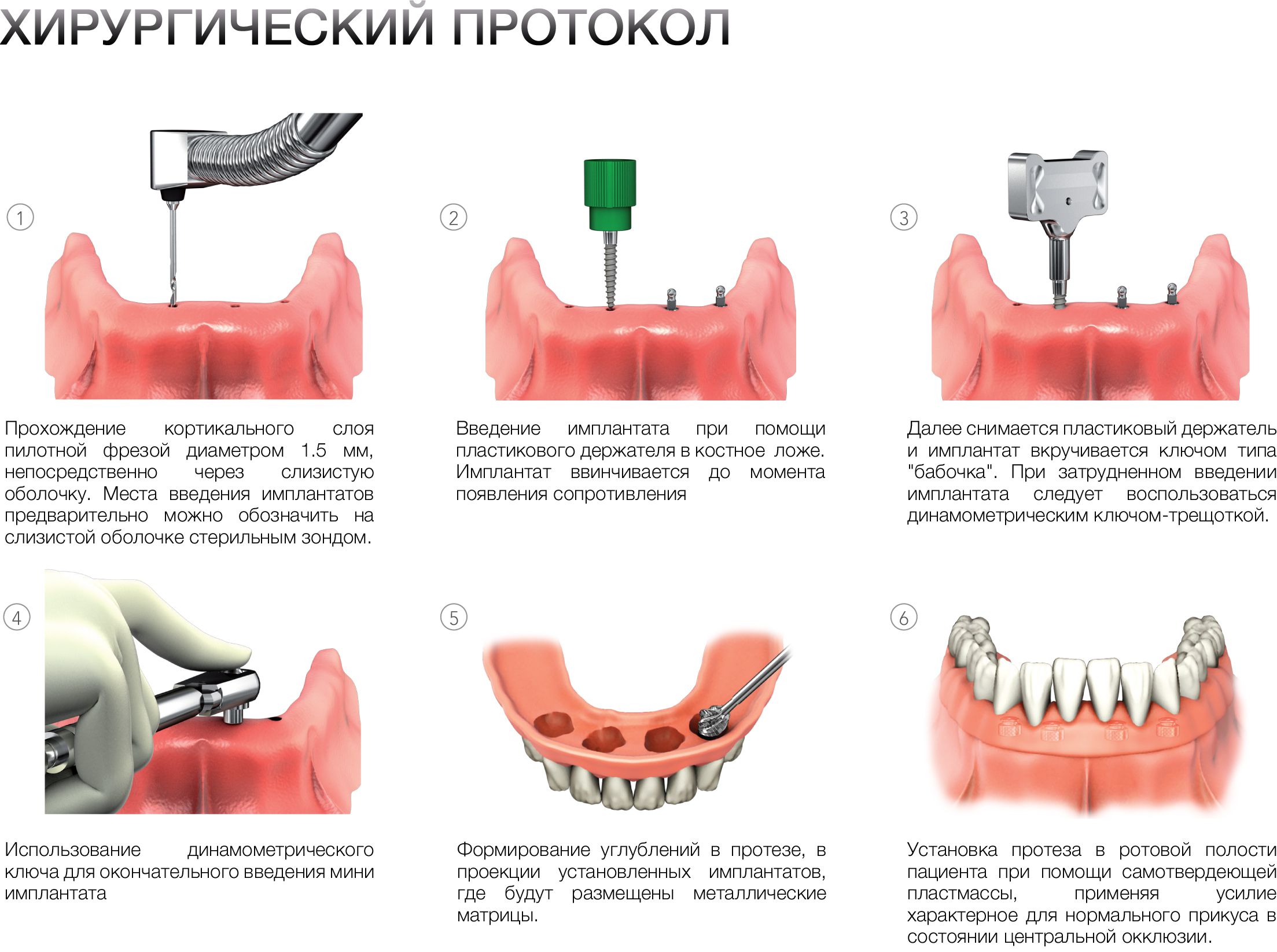 protocol-liko-m-mini.jpg
